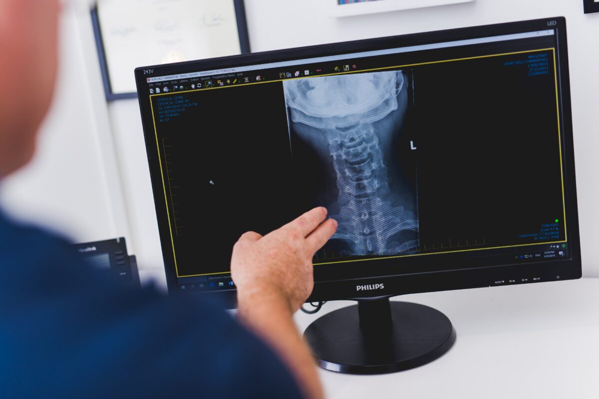 A clinician reviewing a cervical spine X-ray on screen