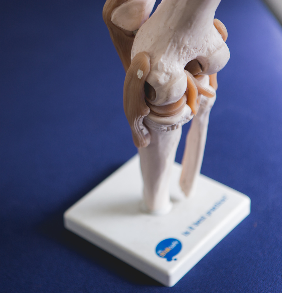 A physiotherapist explaining an injury using a knee model