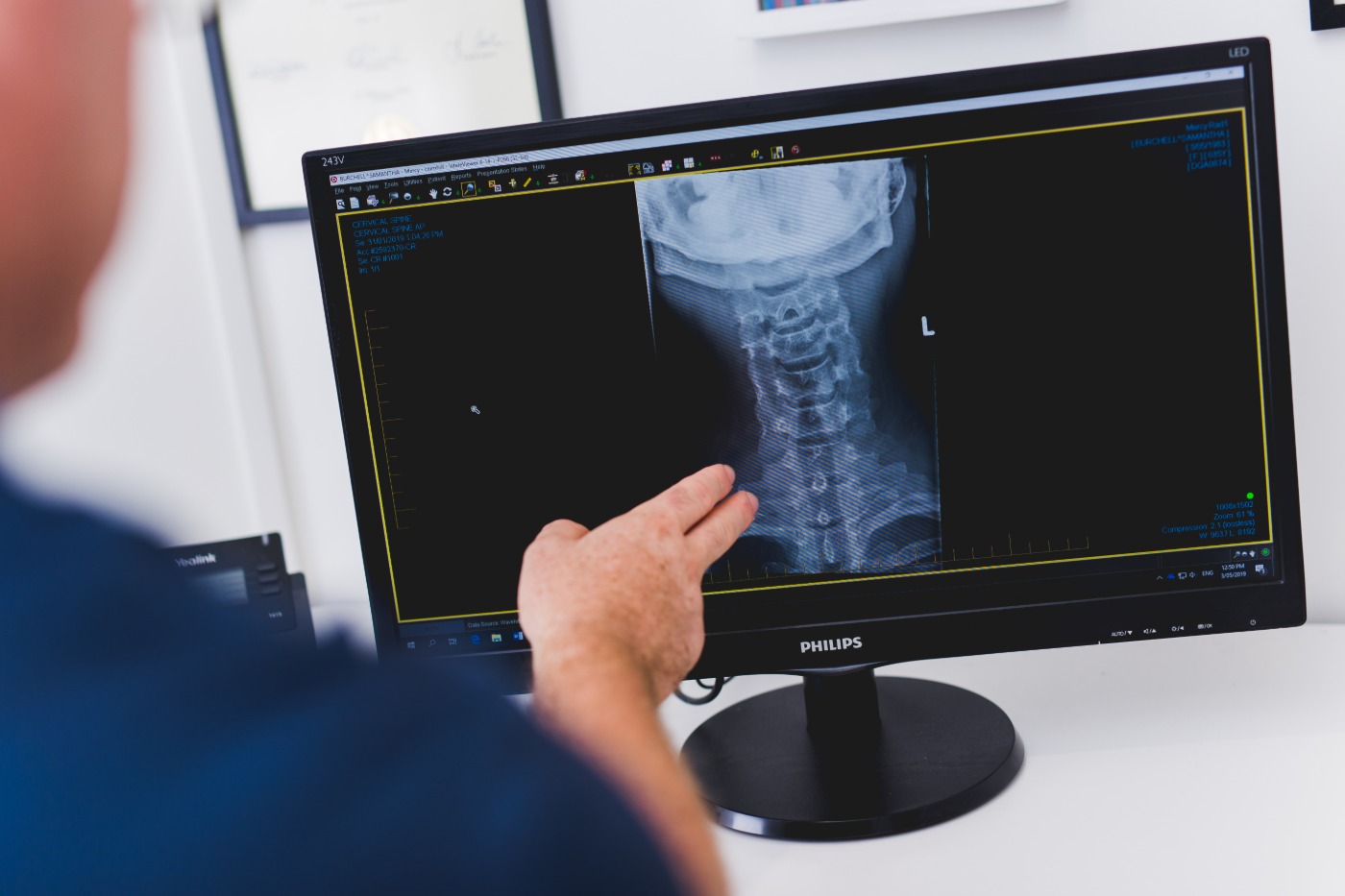 A physiotherapist reviewing a cervical spine X-ray on screen