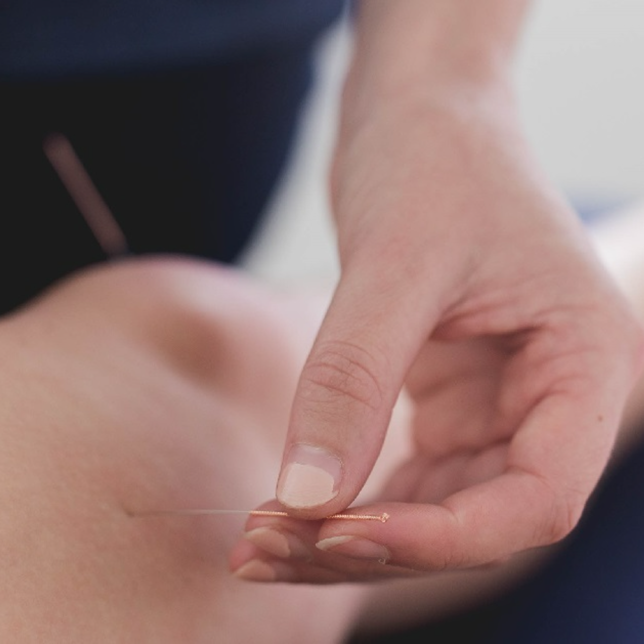 A physiotherapist placing an acupuncture needle