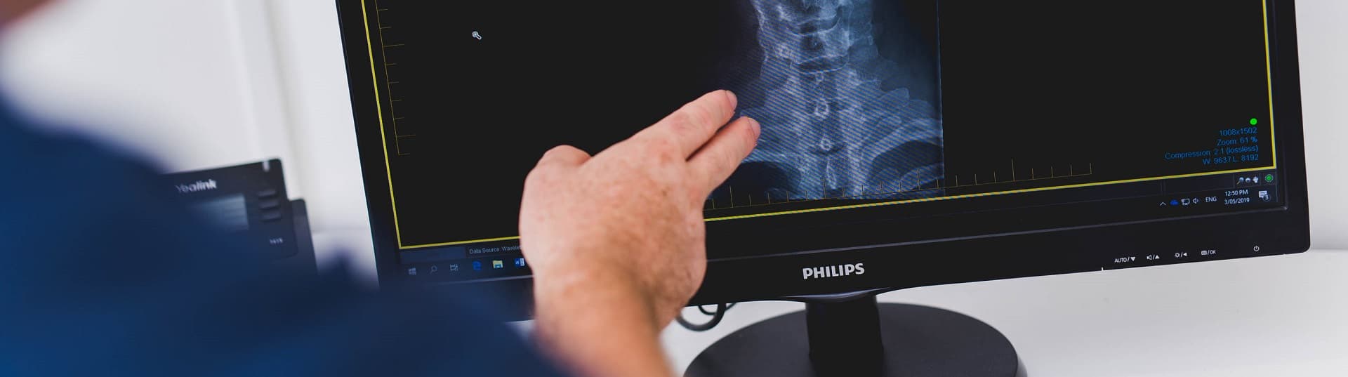 A physiotherapist reviewing a neck X-ray on screen